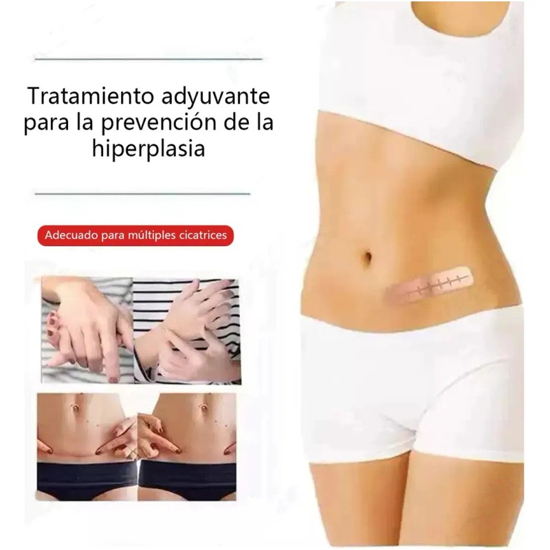 2 cajas Parche de silicona para cicatrices, adecuado para cicatrices