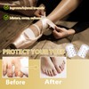 40 Pcs Toe Protector