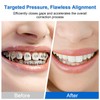 Keilend Orthodontic Rubber Bands, 500 Pcs Teeth Gap Bands with