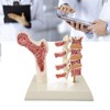 Osteoporosis Spine Model for Teaching and Demonstration, Visualize Bone Density