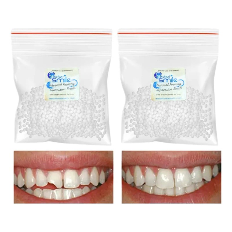Perlas Adhesivas Moldea Dientes Sonrisa Perfecta Pack