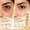 Suero Para Ojos Retinol Colágeno Cafeína Péptidos 15ml 2pcs