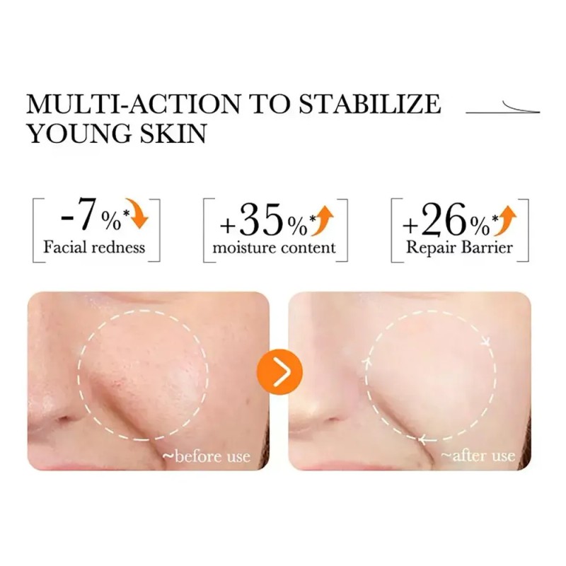 Sérum Facial Con Vitamina C, Antioxidante, Brillo, Antiacné,
