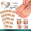 100PCS Ingrown Toenail Correction Patches, for Ingrown Toenail Treatment, Effective