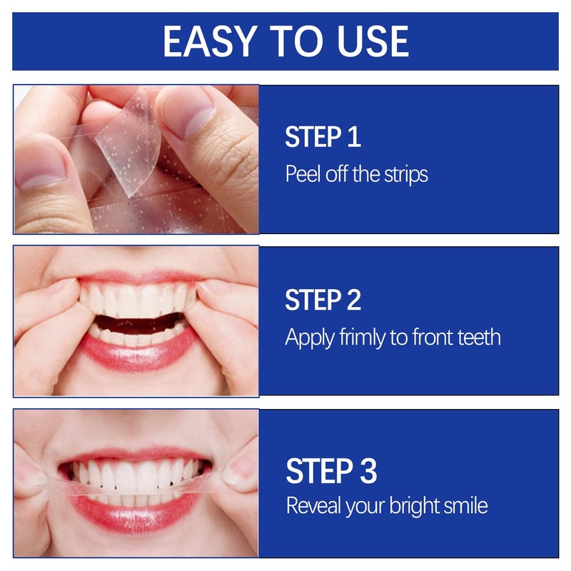 SSKHE Pack of 28 Teeth Whitening Bands, 9D Teeth Whitening