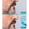 Medi Grade Nose Waxing Beads and Replacement Tips for the