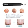 Blackhead Acne Extraction Tweezers - FEITA Pro & Surgical-Grade Stainless