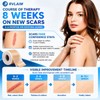 UPF50+ Silicone Scar Sheets with UV Protection(1.8”x 157" Roll 4M)