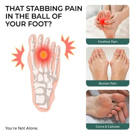 Welnove Metatarsal Pads with Bunion Relief - Upgraded Plush Lining - Ball of Foot Cushions for Metatarsalgia, Sesamoiditis, Morton's Neuroma - Forefoot Protection Sleeve with for Women Men (Size S)