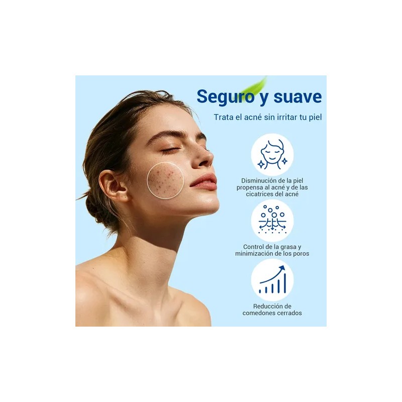 Acne Buster Loción Secante Con Ácido Salicílico 10ml Todo Tipo