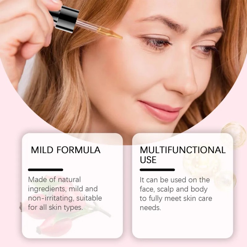 Mopoyat Aceite De For El Crecimiento Del Cabello Con 3pcs