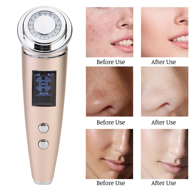 Ultrasonic Magnetic Photon Therapy Cleansing Firming Lifting Beauty Machine Device