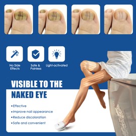 JOJOCOSMO Nail Fungus Cleaning Light Device