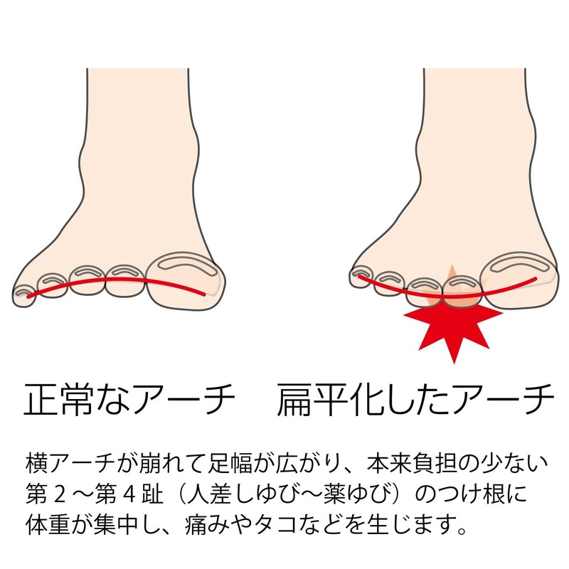 Murai Insole Pro (Shoe Insole) Metatarsal Head Pain Prevention for