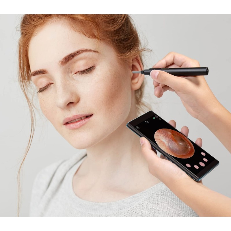 Lifenaxx Wi-Fi Otoscope with Spoons for Earwax Removal, Equipped with