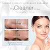 Wireless Ultrasonic Skin Care Scrubber by Project E Beauty |