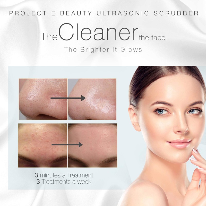 Wireless Ultrasonic Skin Care Scrubber by Project E Beauty |