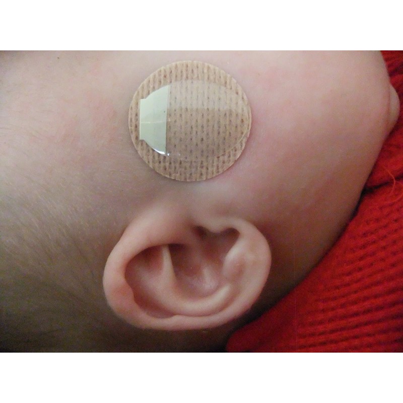 THE OXYGEN STORE Tender Grip Cannula & Tubing Skin Fixation