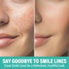 UpdateClassic Smile Line Patches, Anti-Wrinkle Face Patches to Smooth Fine