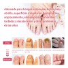 Líquido Para Hongos En Las Uñas Tratamiento Efectivo 50ml