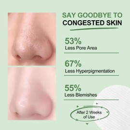 Zero Pore Pads, Dual-Textured Facial Toner Pads for Gentle Exfoliation, Deep Cleansing & Pore Minimizing, Exfoliating Face Pad for Smooth, Clear Skin, Ideal for All Skin Types, 70 Pcs