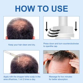 60 ml Hair Growth Serum, Hair Growth Serum, Hair Growth Agent Women & Men, Thickening and Strengthening for Hair Growth, Hair Care and Strengthening Hair Roots, Used for Sparse Hair