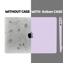 Anban Compatible with MacBook Pro 13 inch Case 2024 2023 M2, 2022-2016 M1 A2338 A2251 A2289 A2159 A1989 A1708 A1706, Plastic Laptop Hard Shell Case +Keyboard Cover +Screen Protector, Purple
