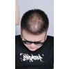 Fibras Capilares Natural Disimular Calvicie Relleno Cabello