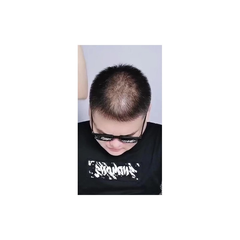 Fibras Capilares Natural Disimular Calvicie Relleno Cabello
