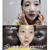 Dermal Matrix Real Collagen Mask Pack 10 Sheets Exfoliation, Skin
