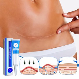 4 Pcs Narbensalbe Narbencreme Narbensalbe Nach Op Narbensalbe Zur Reduzierung Reparaturcreme FüR Narben Narbensalbe Nach Op Narbensalbe Narbencreme Narbensalbe Nach Op Narbensalbe Zur Reduzierung