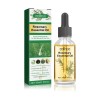 El Aceite Esencial De Romero Para El Cabello Reduce La Caída