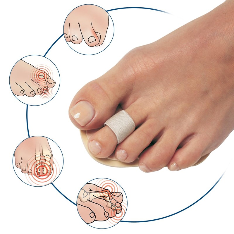 Pedifix Budin Toe Straightener with Metatarsal Cushion Pad