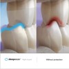 Sleepeeze Night Guard - Custom Fit Mouth Guard Designed For