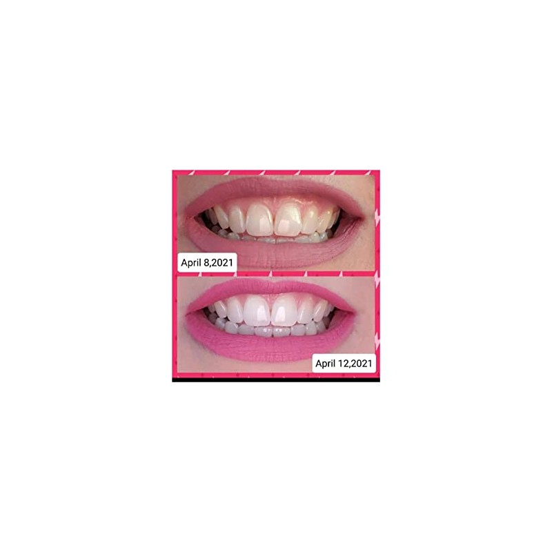 Farmasi Whitening Pasta de Dientes 112g