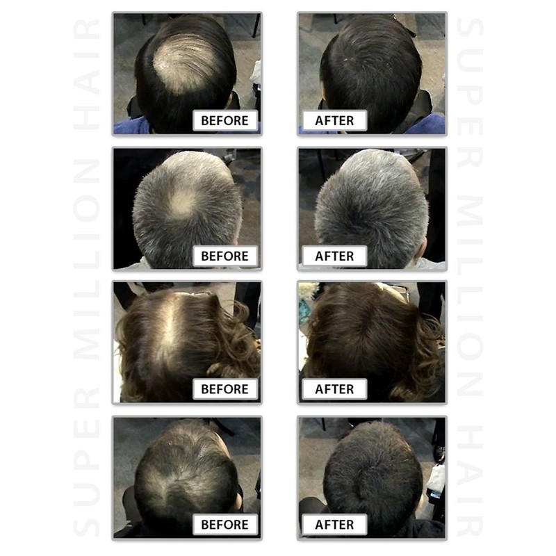 Super Million Hair - 1 x 25g Hair Building Fibres