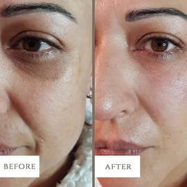 LuxeBiotics Dark Circle, Eye Bag Anti-Wrinkle Nourishing Eye Cream