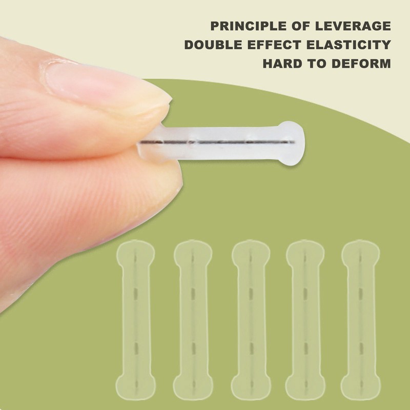 10pcs Toenail Correction Strips Brace Elastic Change Growth Direction Ingrown