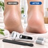 Pedicure Tools Foot Care File Set for Callus Care –