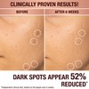 Charlotte Tilbury | Dark Spot Correcting Radiance Recovery Serum |