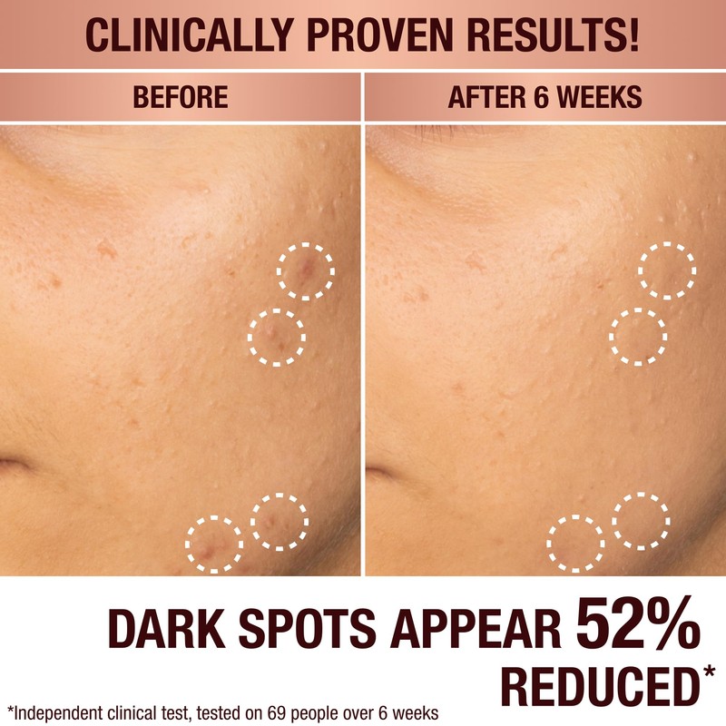 Charlotte Tilbury | Dark Spot Correcting Radiance Recovery Serum |
