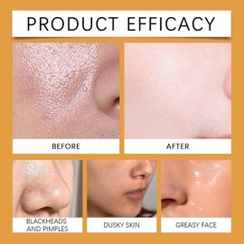 Turmeric & Vitamin C Face Scrub Exfoliator,Natural Facial Exfoliating Body Scrub,Facial Peeling Cream Brightening Srub for Women&Men-Improve Dark Spots Blackheads Acne,Even Skin Tone Skin Care, 100g