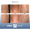 Pfb Vanish Hair Treatment