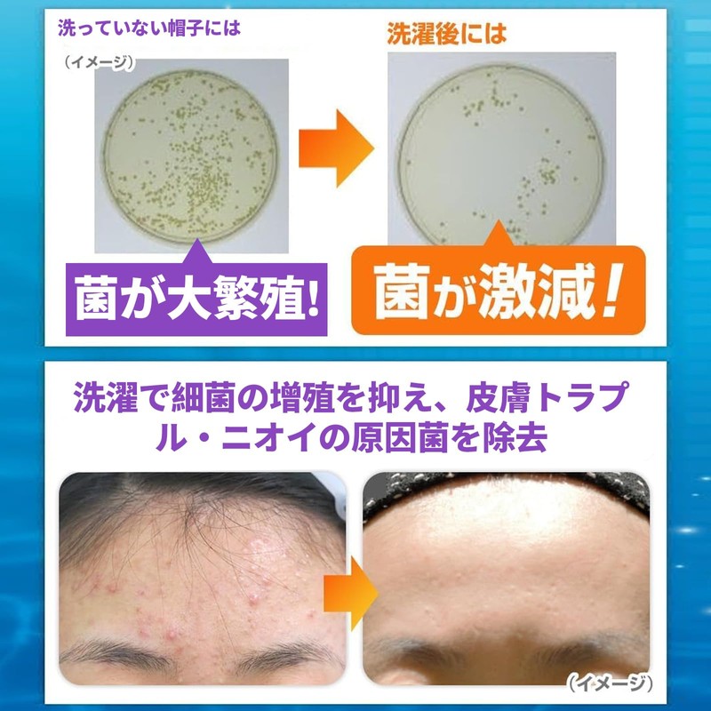 キャップウォッシャー 帽子 洗濯 キャップ ウォッシャー 手洗いの面倒から解放 型崩れ防止 帽子 男女兼用 野球帽