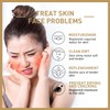 (100% Effective) 2024 New 1/2/3Pcs 𝐑𝐢𝐜𝐞 𝐓𝐨𝐧𝐞𝐫, 𝐌𝐢𝐥𝐤𝐲 𝐓𝐨𝐧𝐞𝐫 𝐟𝐨𝐫