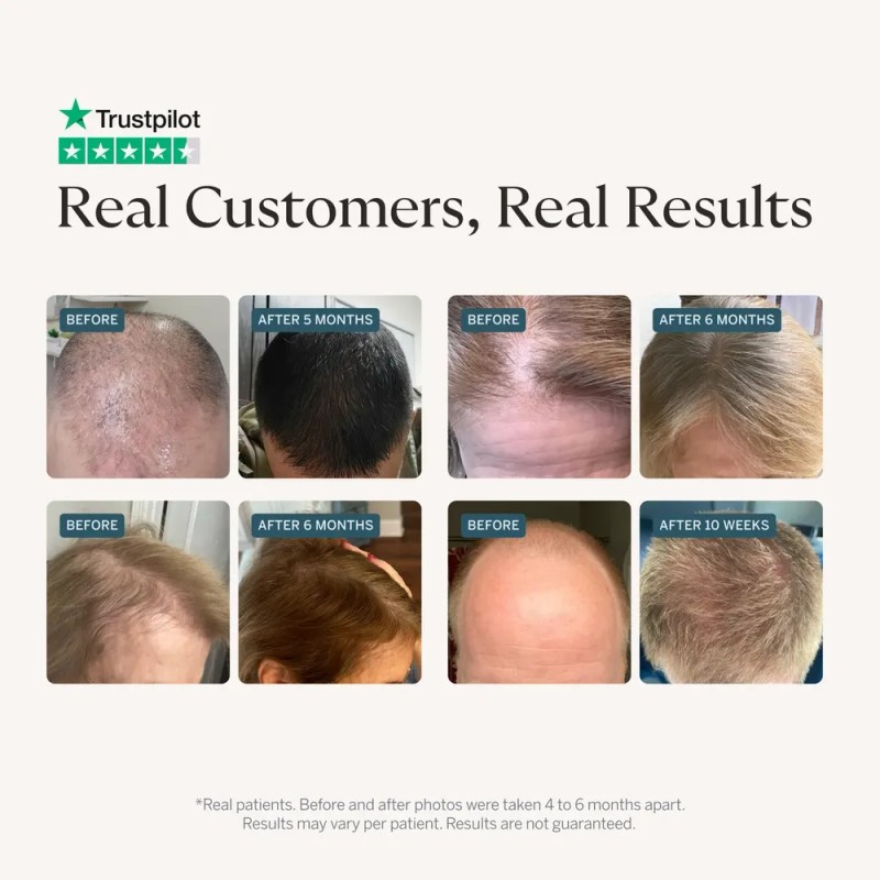Head Hair Serum For Men & Women With Procapil Biotin,