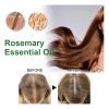 Aceite Esencial De Romero Para El Crecimiento Del Cabello