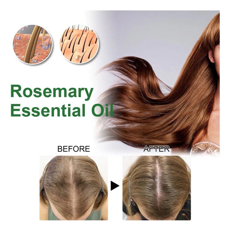 Aceite Esencial De Romero Para El Crecimiento Del Cabello