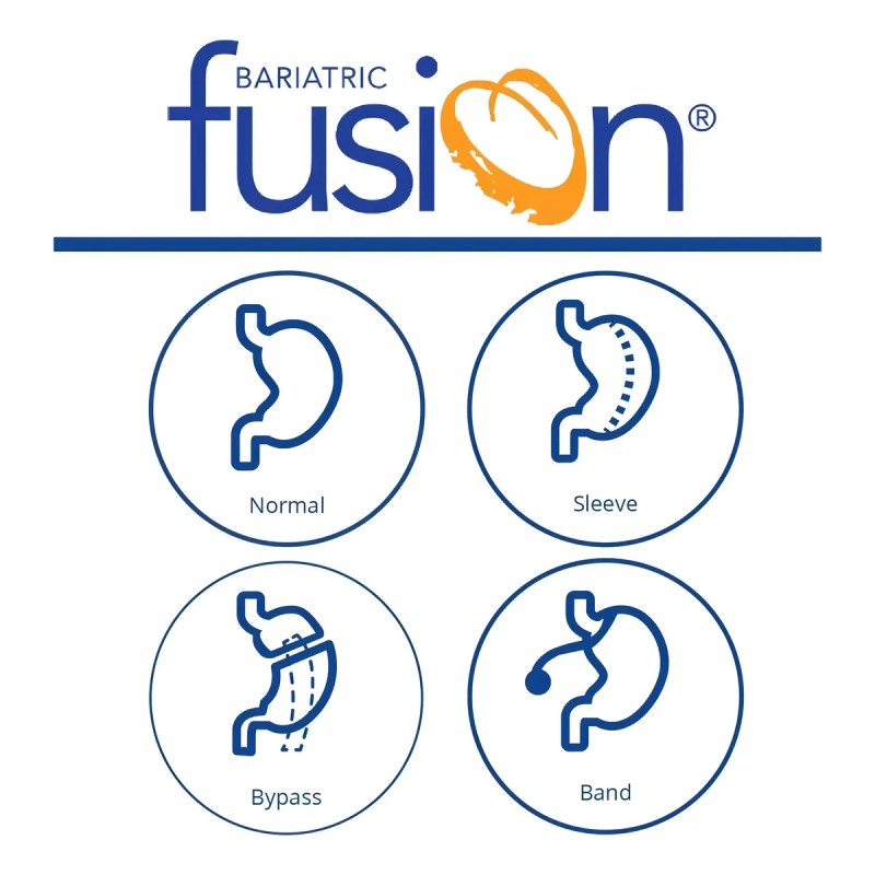 Bariatric Fusion Women´s Multivitamin One Per Day 30 Cáps Sabor