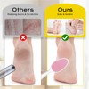 yomanta Foot File, Nano Glass Foot File Callus Remover with